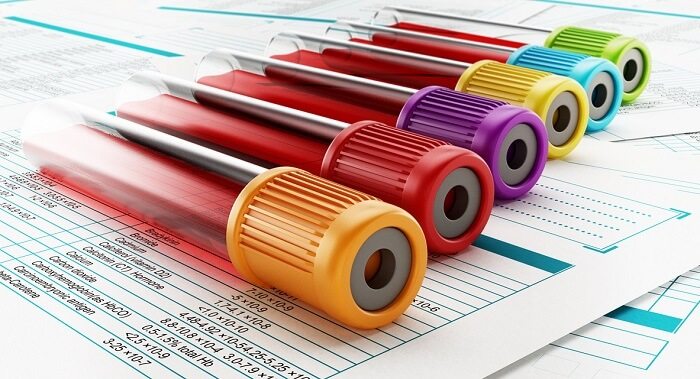 Blood test tubes with multi-colored lids standing on medical documents