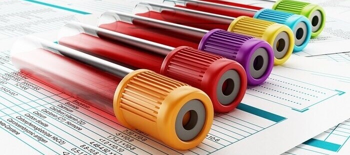blood test health assessment - bottles with data report