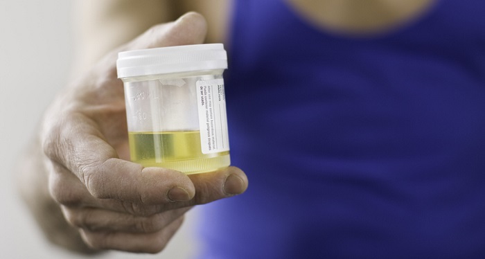 urine test patient holding cup