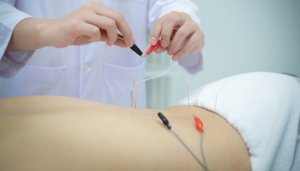doctor treating patient with electroacupuncture