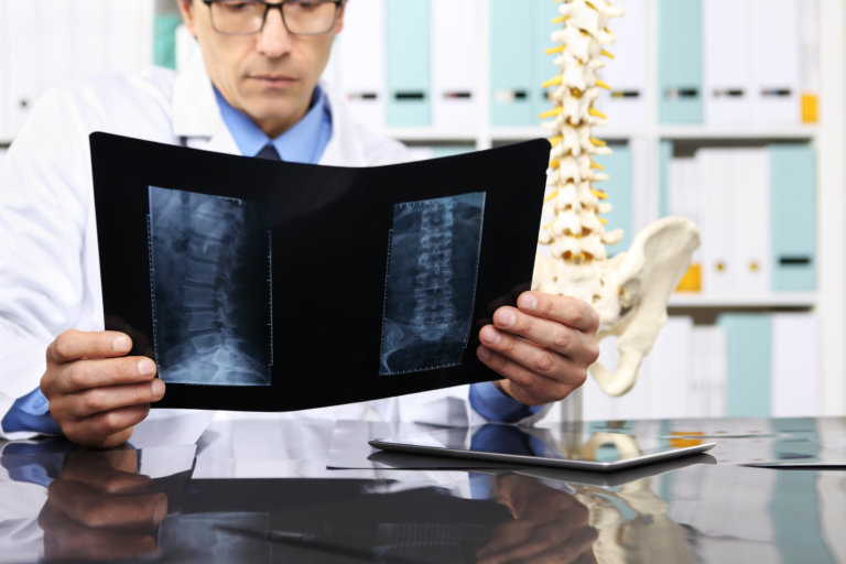 doctor looking at spine x-rays in office