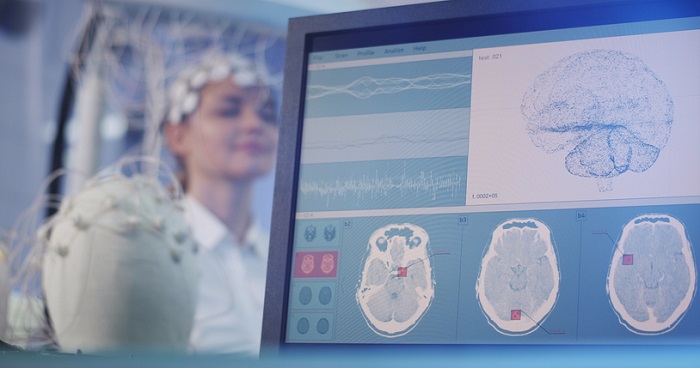 young woman connected to eeg biofeedback machine