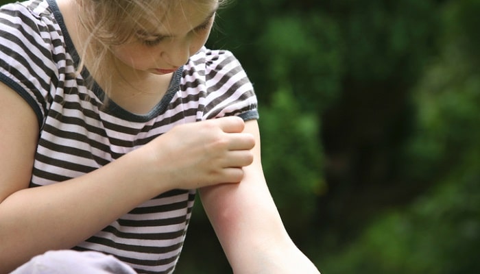 girl looking at bug bite on her arm