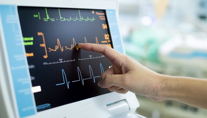 Pointing at heart rate variability on EKG monitor