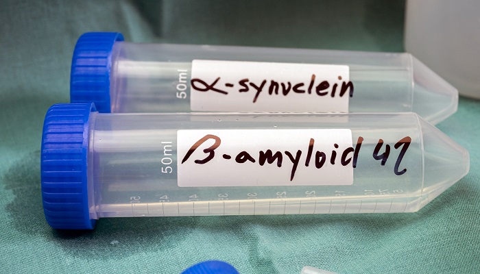biomarkers labeled on test tubes