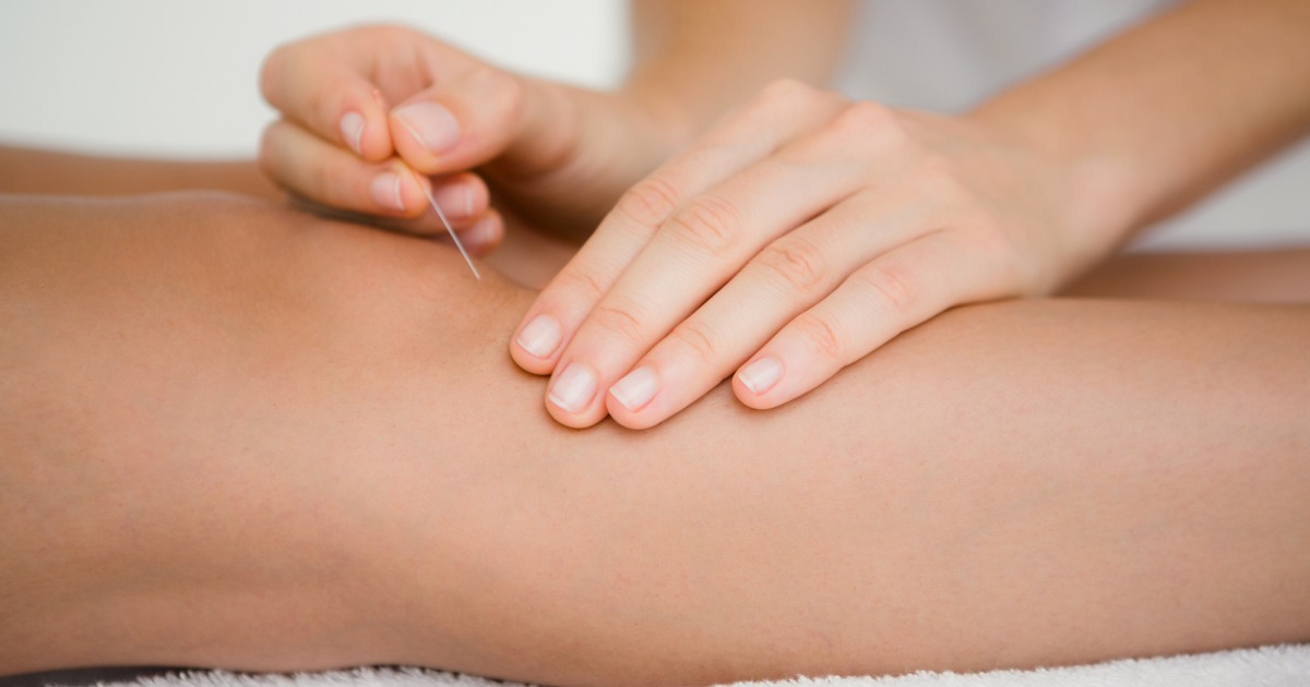 placing acupuncture needle below knee