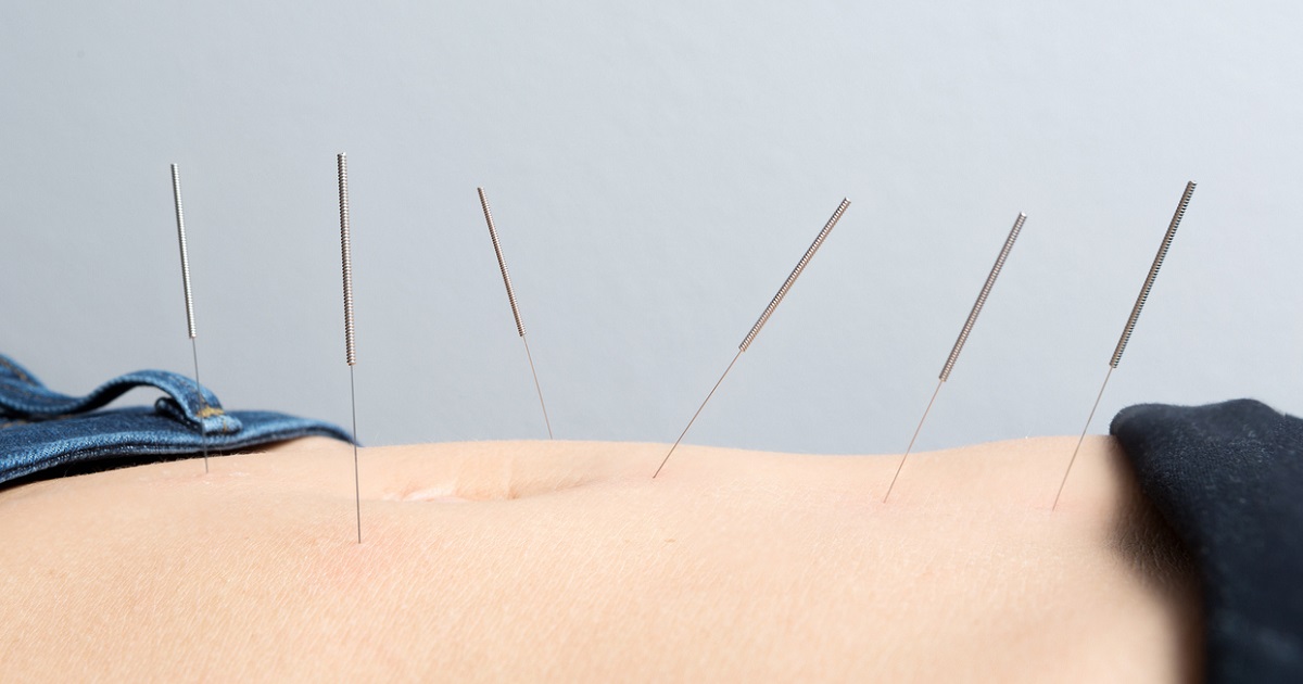 acupuncture needles on stomach conception meridian
