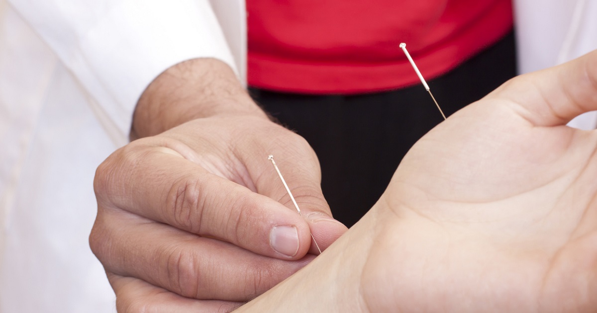 placing needles on lung acupuncture point
